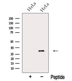 Invitrogen NIP30 Polyclonal Antibody 100 &mu;L; Unconjugated:Antibodies,