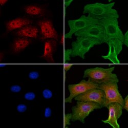 Invitrogen NME5 Polyclonal Antibody 100 &mu;L; Unconjugated:Antibodies,