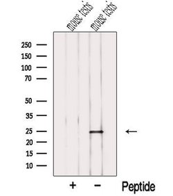 Invitrogen NME5 Polyclonal Antibody 100 &mu;L; Unconjugated:Antibodies,