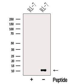 Invitrogen NOXA Polyclonal Antibody 100 &mu;L | Buy Online | Invitrogen&trade; | Fisher Scientific