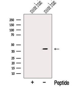 Invitrogen NUDT9 Polyclonal Antibody 100 &mu;L | Buy Online | Invitrogen&trade; | Fisher Scientific