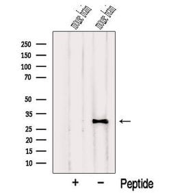 Invitrogen NUS1 Polyclonal Antibody 100 &mu;L | Buy Online | Invitrogen&trade; | Fisher Scientific