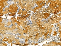 Invitrogen OCIAD1 Polyclonal Antibody 100 &mu;L; Unconjugated:Antibodies,