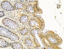Invitrogen ODF2L Polyclonal Antibody 100 &mu;L; Unconjugated:Antibodies,