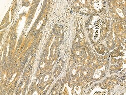 Invitrogen ODF2L Polyclonal Antibody 100 &mu;L; Unconjugated:Antibodies,