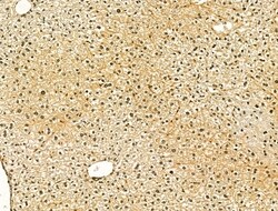 Invitrogen ODF2L Polyclonal Antibody 100 &mu;L; Unconjugated:Antibodies,