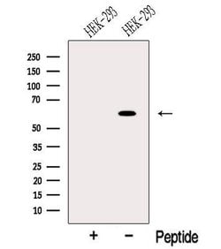 Invitrogen ODF2L Polyclonal Antibody 100 &mu;L; Unconjugated:Antibodies,