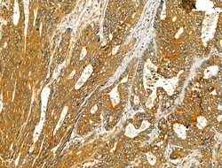 Invitrogen TENM1 Polyclonal Antibody 100 &mu;L; Unconjugated:Antibodies,