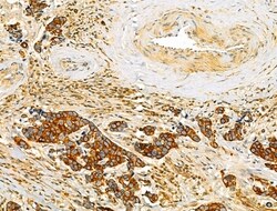 Invitrogen TENM1 Polyclonal Antibody 100 &mu;L; Unconjugated:Antibodies,