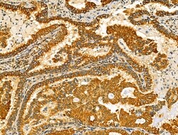 Invitrogen TENM1 Polyclonal Antibody 100 &mu;L; Unconjugated:Antibodies,