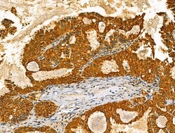Invitrogen TENM1 Polyclonal Antibody 100 &mu;L; Unconjugated:Antibodies,