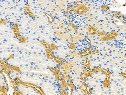 Invitrogen TENM1 Polyclonal Antibody 100 &mu;L; Unconjugated:Antibodies,