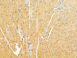 Invitrogen OGDHL Polyclonal Antibody 100 &mu;L; Unconjugated:Antibodies,