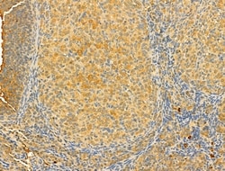 Invitrogen OGDHL Polyclonal Antibody 100 &mu;L; Unconjugated:Antibodies,