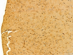 Invitrogen OGDHL Polyclonal Antibody 100 &mu;L; Unconjugated:Antibodies,