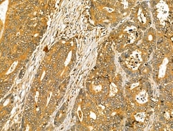 Invitrogen OGDHL Polyclonal Antibody 100 &mu;L; Unconjugated:Antibodies,