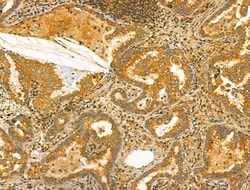 Invitrogen OGDHL Polyclonal Antibody 100 &mu;L; Unconjugated:Antibodies,
