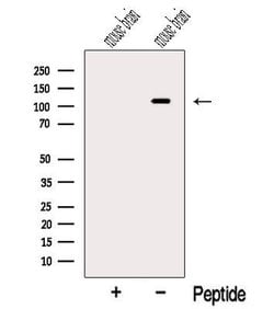 Invitrogen OGDHL Polyclonal Antibody 100 &mu;L; Unconjugated:Antibodies,