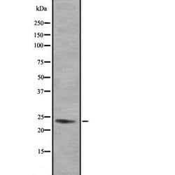 Invitrogen GEM Polyclonal Antibody 100 &mu;L; Unconjugated:Antibodies,
