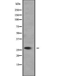 Invitrogen UCP4 Polyclonal Antibody 100 &mu;L; Unconjugated:Antibodies,