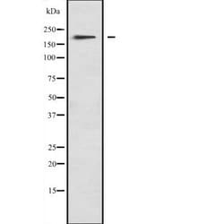 Invitrogen MYO1F Polyclonal Antibody 100 &mu;L | Buy Online | Invitrogen&trade; | Fisher Scientific