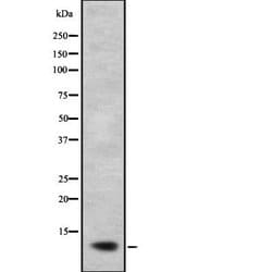 Invitrogen NDUFB2 Polyclonal Antibody 100 &mu;L | Buy Online | Invitrogen&trade; | Fisher Scientific