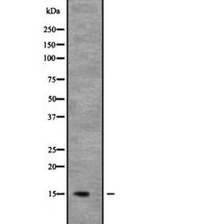 Invitrogen NDUFB6 Polyclonal Antibody 100 &mu;L | Buy Online | Invitrogen&trade; | Fisher Scientific