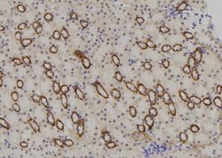 Invitrogen NBPF4 Polyclonal Antibody 100 &mu;L; Unconjugated:Antibodies,