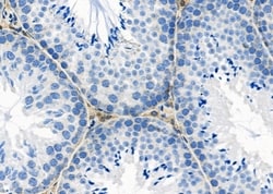 Invitrogen NBPF4 Polyclonal Antibody 100 &mu;L; Unconjugated:Antibodies,