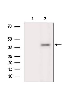 Invitrogen NeuroD6 Polyclonal Antibody 100 &mu;L; Unconjugated:Antikroppar