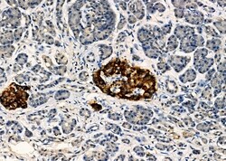 Invitrogen PEX1 Polyclonal Antibody 100 &mu;L; Unconjugated:Antibodies,