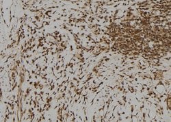 Invitrogen RFPL1 Polyclonal Antibody 100 &mu;L; Unconjugated:Antibodies,