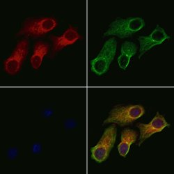 Invitrogen RIOK2 Polyclonal Antibody 100 &mu;L; Unconjugated:Antibodies,