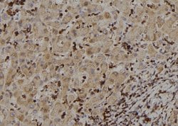 Invitrogen RIOK2 Polyclonal Antibody 100 &mu;L; Unconjugated:Antibodies,