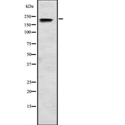 Invitrogen SCN3A Polyclonal Antibody 100 &mu;L; Unconjugated:Antibodies,