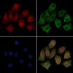 Invitrogen eIF2b beta Polyclonal Antibody 100 &mu;L; Unconjugated:Antibodies,