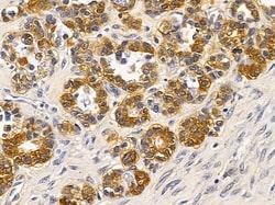 Invitrogen eIF2b beta Polyclonal Antibody 100 &mu;L; Unconjugated:Antibodies,