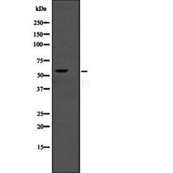 Invitrogen TSEN2 Polyclonal Antibody 100 &mu;L | Buy Online | Invitrogen&trade; | Fisher Scientific