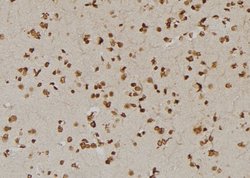 Invitrogen USP1 Polyclonal Antibody 100 &mu;L | Buy Online | Invitrogen&trade; | Fisher Scientific