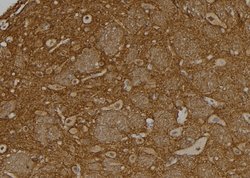 Invitrogen USP37 Polyclonal Antibody 100 &mu;L | Buy Online | Invitrogen&trade; | Fisher Scientific
