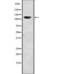Invitrogen USP37 Polyclonal Antibody 100 &mu;L | Buy Online | Invitrogen&trade; | Fisher Scientific