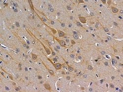 Invitrogen Adenylate Cyclase 8 Polyclonal Antibody 100 &mu;L; Unconjugated:Antibodies,