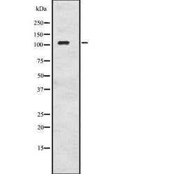 Invitrogen Adenylate Cyclase 8 Polyclonal Antibody 100 &mu;L; Unconjugated:Antibodies,