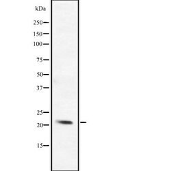 BCL2L10 Polyclonal Antibody, Invitrogen 100 &mu;L; Unconjugated:Antibodies,