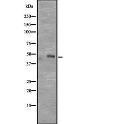 Invitrogen CD177 Polyclonal Antibody 100 &mu;L | Buy Online | Invitrogen&trade; | Fisher Scientific