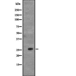 Invitrogen&trade;&nbsp;CD63 Polyclonal Antibody