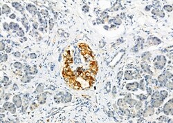 Invitrogen CD97 Polyclonal Antibody 100 &mu;L; Unconjugated:Antibodies,
