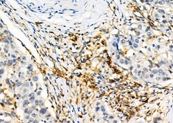 Invitrogen CD97 Polyclonal Antibody 100 &mu;L; Unconjugated:Antibodies,
