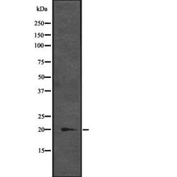 Invitrogen CENPM Polyclonal Antibody 100 &mu;L; Unconjugated:Antibodies,