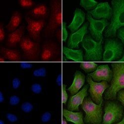 Invitrogen CENPN Polyclonal Antibody 100 &mu;L; Unconjugated:Antibodies,